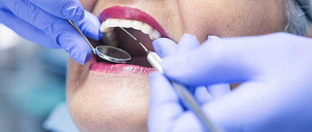 Best Emergency Treatment for Dental Infections or Abscesses in Summerville, GA